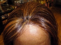 Lace Frontal