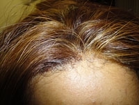 Lace Frontal